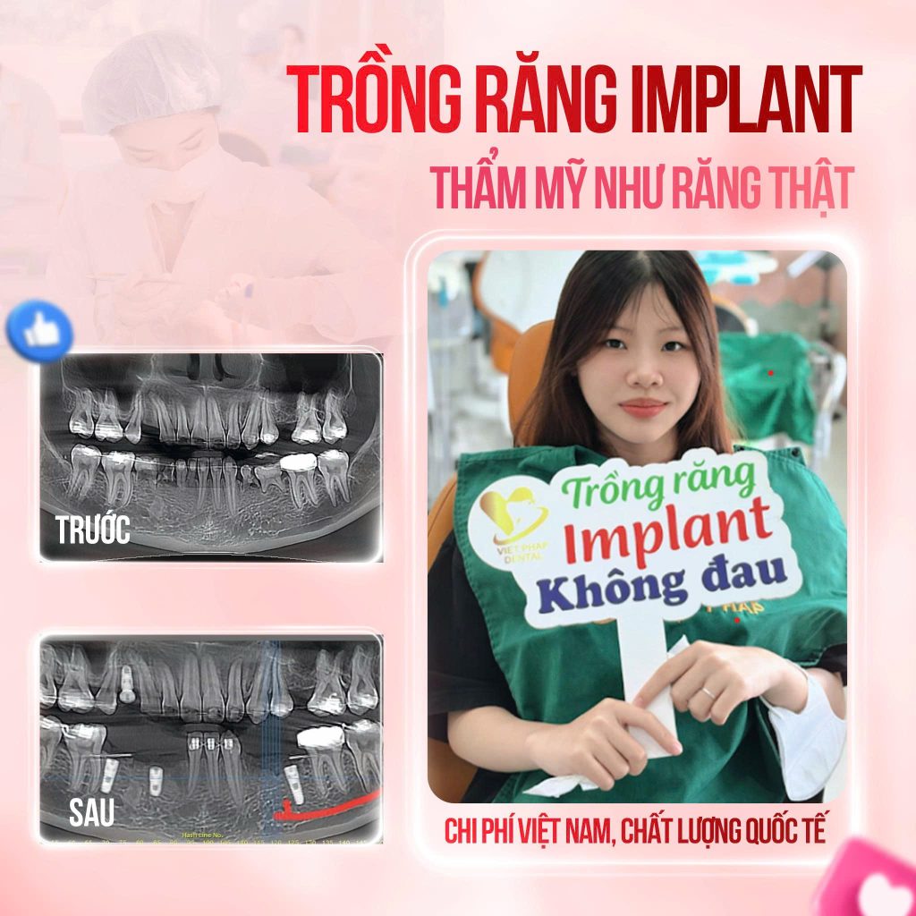 khach-hang-trong-rang-uu-dai (3)