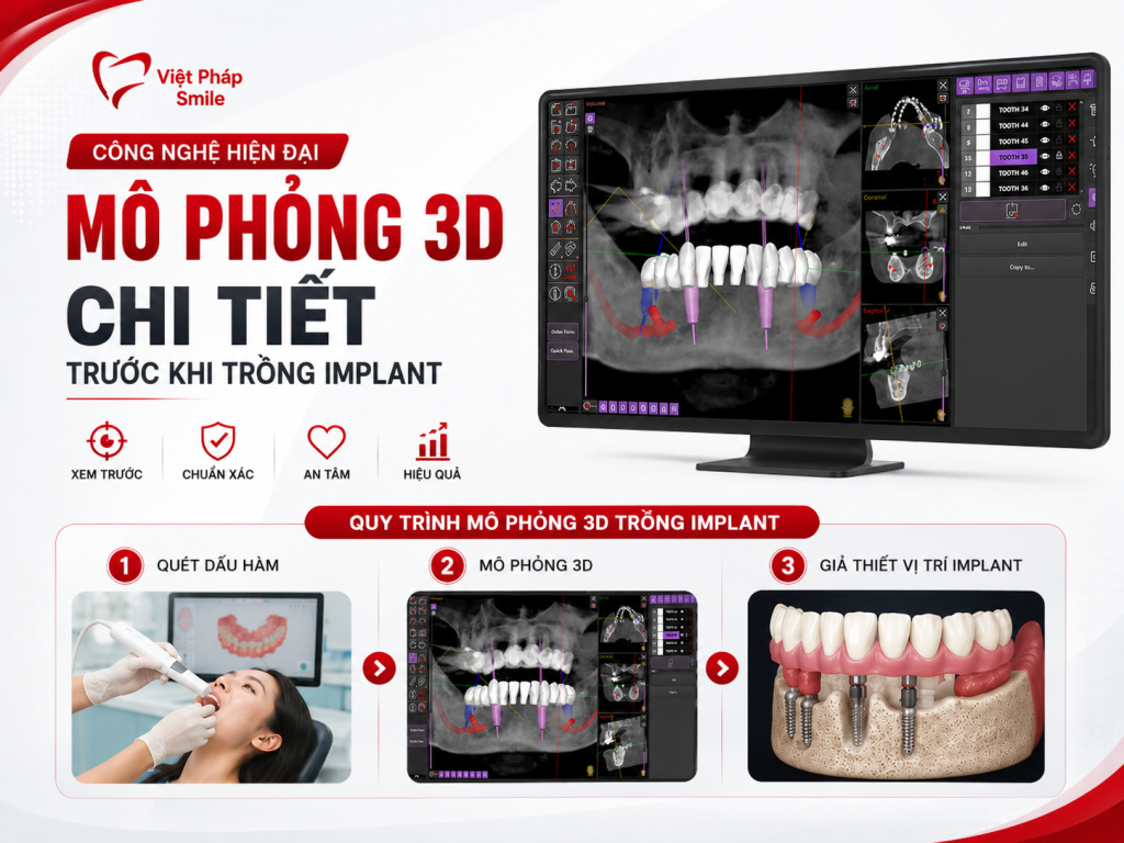 Top nha khoa uy tín tại TP.HCM được khách hàng đánh giá cao 5 mo-phong-3d