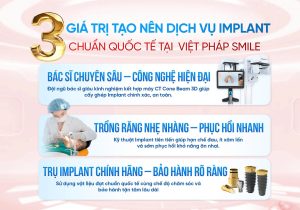 uu-diem-cua-nha-khoa-viet-phapp-smile-ve-dich-vu-implant