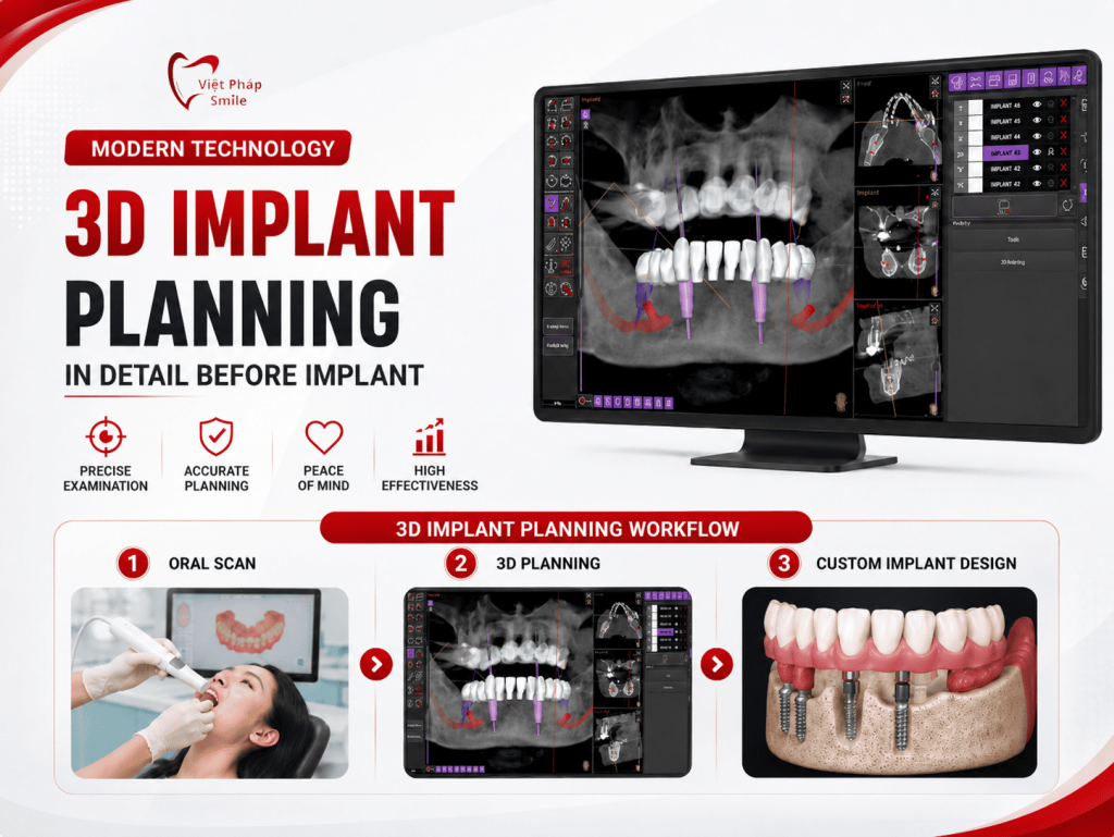 3d implant planning (1)