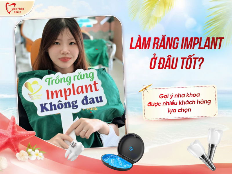Làm răng Implant ở đâu tốt Gợi ý nha khoa được nhiều khách hàng lựa chọn