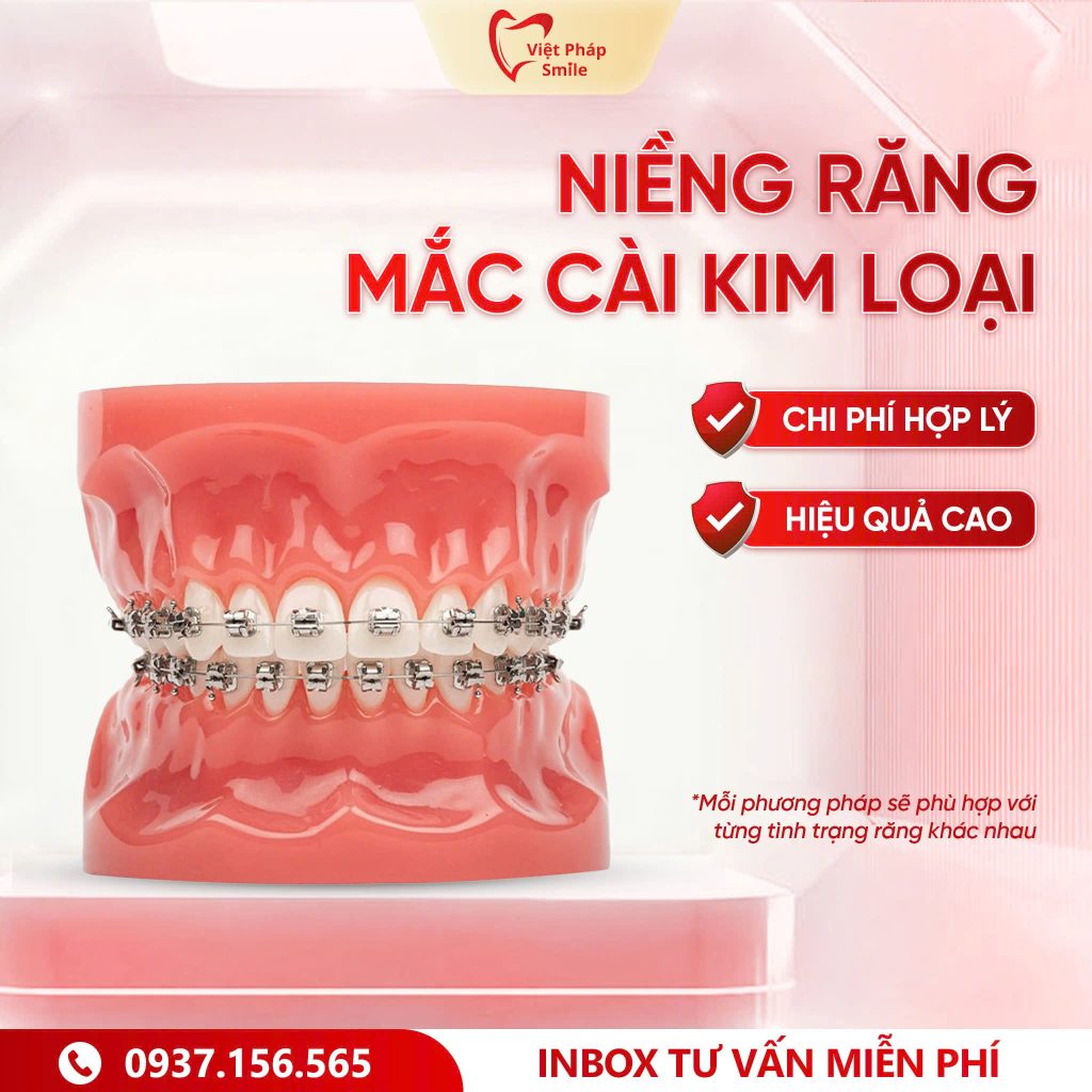Nieng rang mac cai kim loai – Giai phap pho bien voi chi phi hop ly