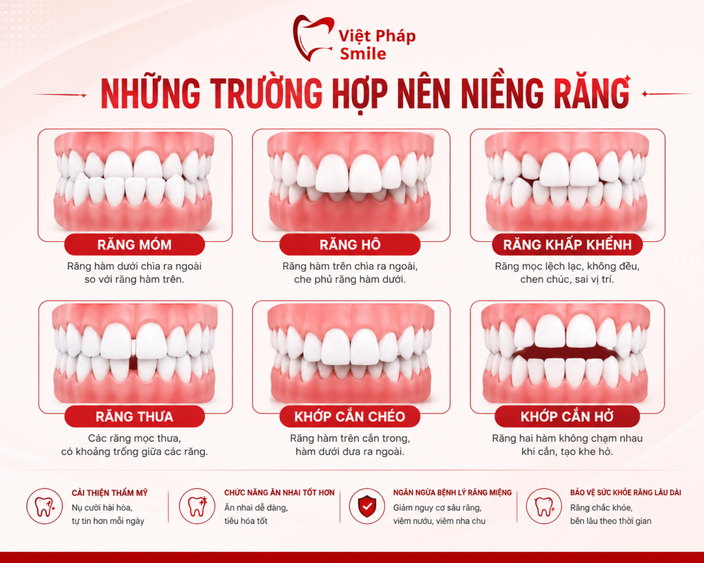 nhung-truong-hop-nen-nieng-rang