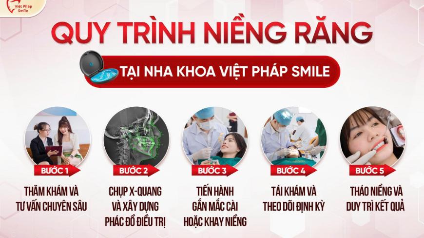 Niềng răng uy tín TP.HCM – Bí quyết sở hữu hàm răng đều đẹp tự nhiên 4 quy-trinh-mieng-rang
